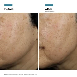 SkinCeuticals A.G.E. Interrupter Ultra Serum 30ml
