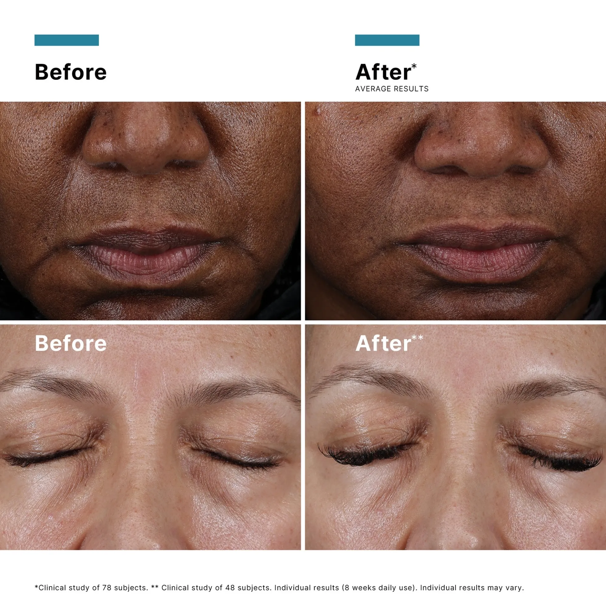 SkinCeuticals Cell Cycle Catalyst 30ml