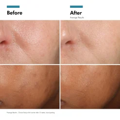 SkinCeuticals Phloretin CF Antioxidant Serum for Normal, Combination, Discolouration-Prone Skin Types
