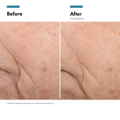 SkinCeuticals Triple Lipid Restore 2:4:2 Anti-Ageing Cream for Dry Skin 48ml