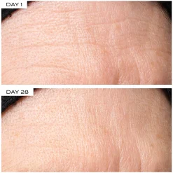 111SKIN Exosome Face Lift Protocol