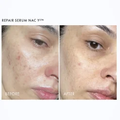 111SKIN Repair + Renew Routine (Worth £205.00)