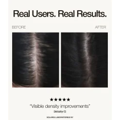 Solaris Labs NY LED Hair Growth PRO Supporting Hat