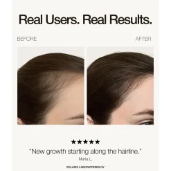 Solaris Labs NY LED Hair Growth PRO Supporting Hat