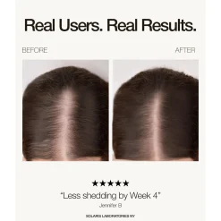 Solaris Labs NY LED Hair Growth PRO Supporting Hat