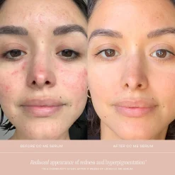SUMMER FRIDAYS CC Me Serum
