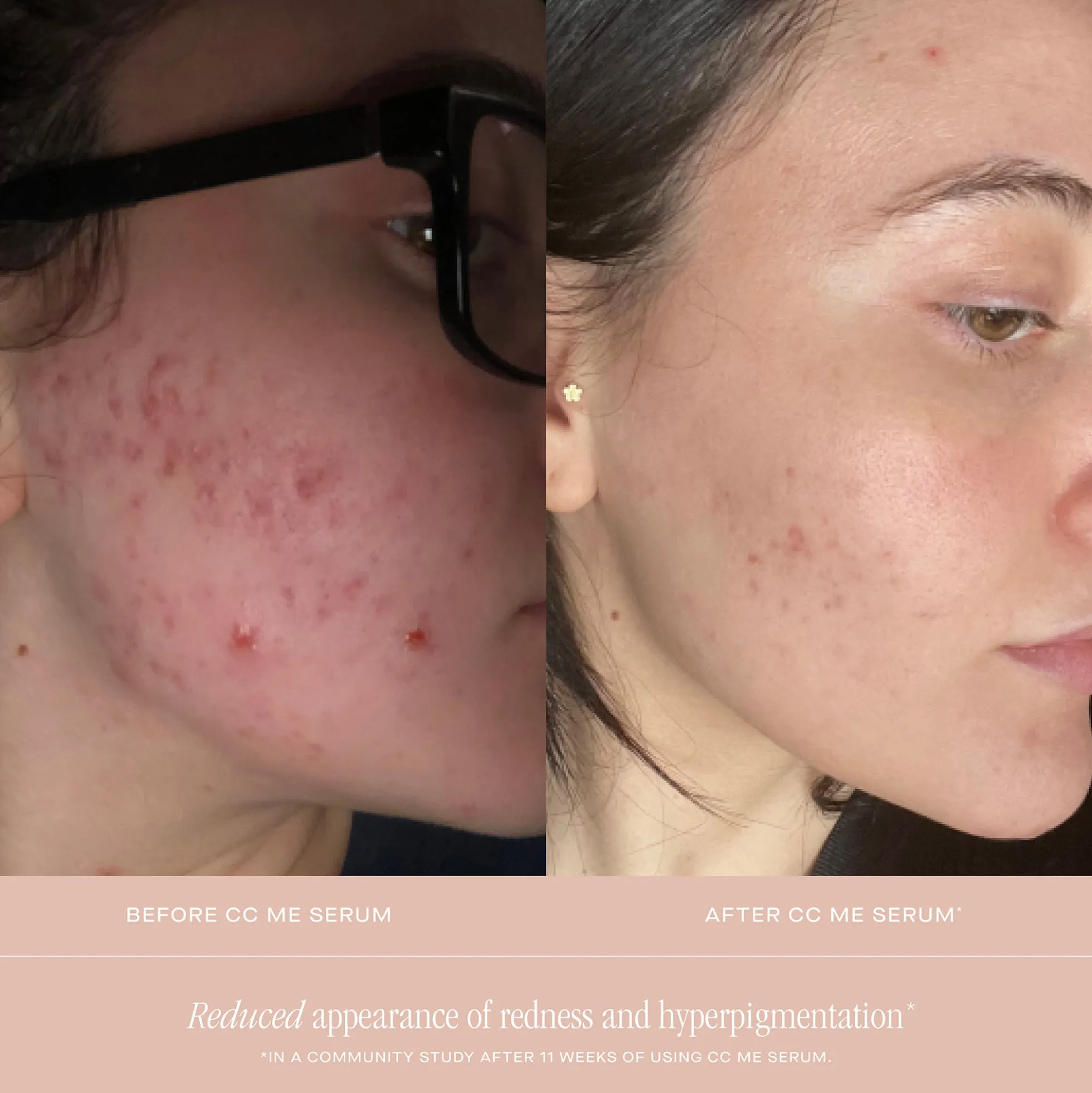SUMMER FRIDAYS CC Me Serum