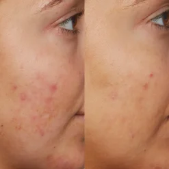 Sunday Riley B3 Nice 10% Niacinamide Serum 30ml