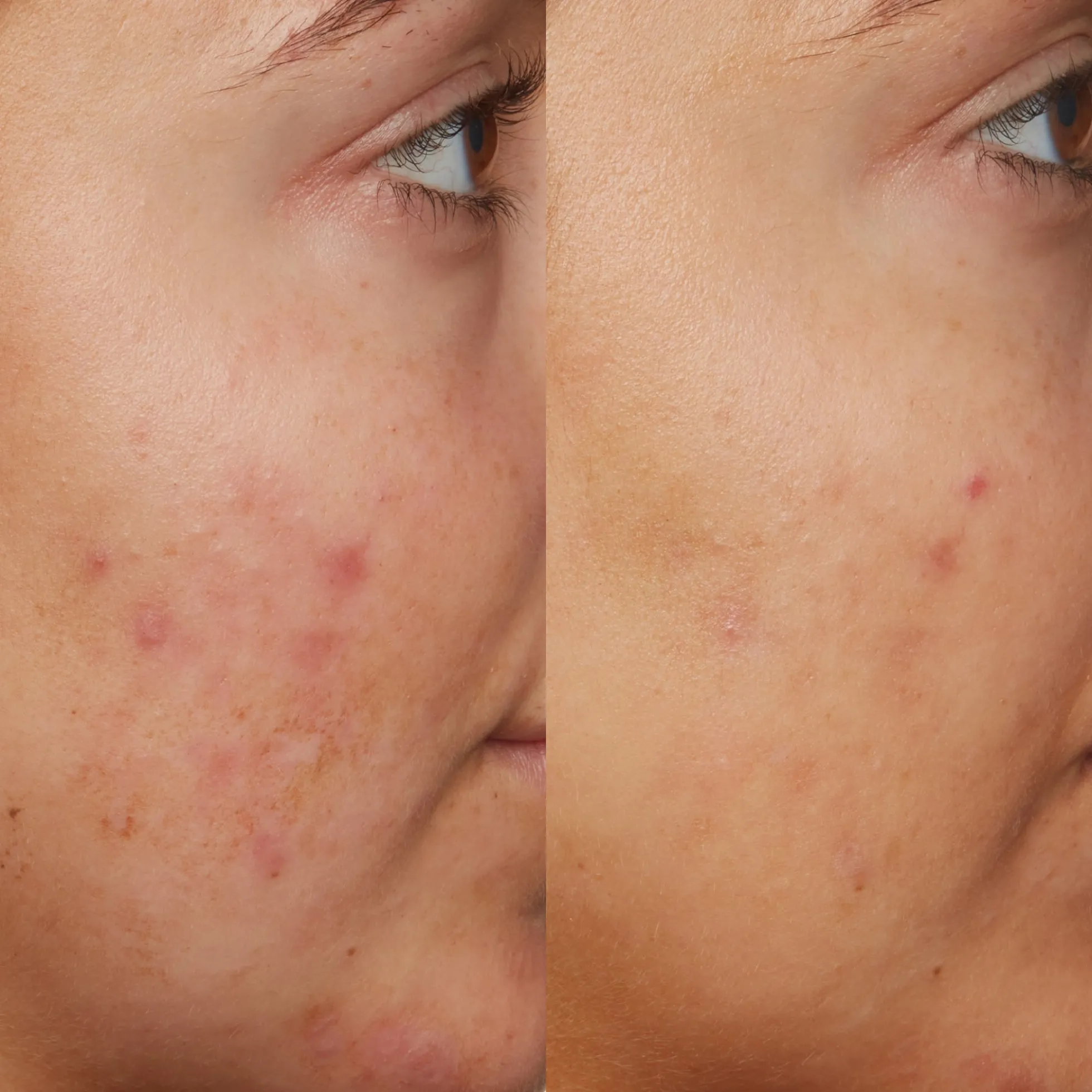 Sunday Riley B3 Nice 10% Niacinamide Serum 30ml