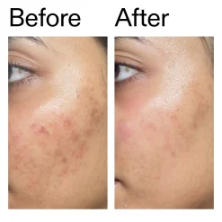 The INKEY List Ectoin Hydro-Barrier Serum 30ml