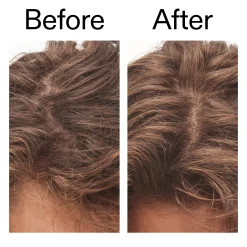 The INKEY List Glycolic Acid Exfoliating Scalp Scrub 150ml