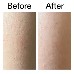 The INKEY List Glycolic Acid Exfoliating Body Stick 45g