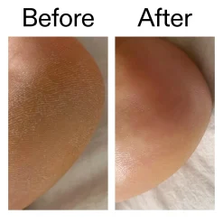 The INKEY List Glycolic Acid Exfoliating Body Stick 45g