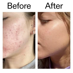 The INKEY List Niacinamide Serum 30ml