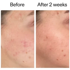 The INKEY List 360 Skin Clearing Serum 30ml