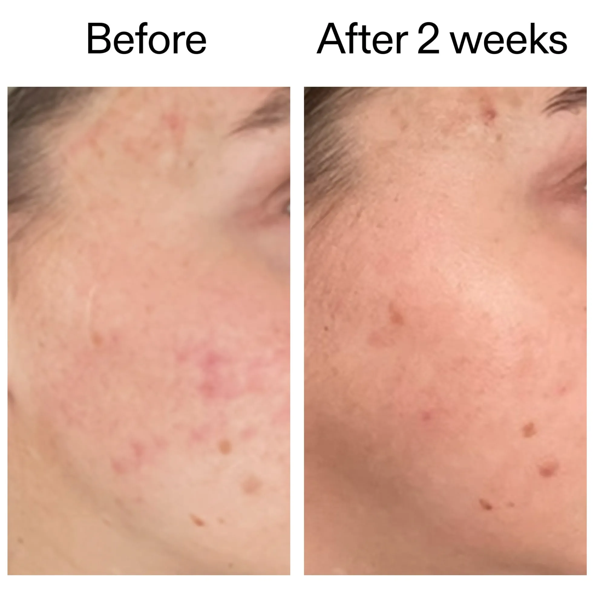 The INKEY List 360 Skin Clearing Serum 30ml