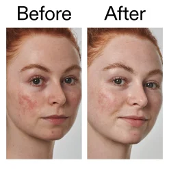 The INKEY List Super Solutions 10% Azelaic Acid Serum 30ml