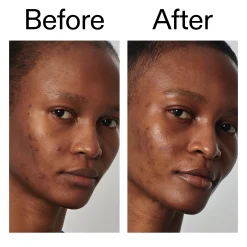 The INKEY List Super Solutions 20% Niacinamide Serum 30ml