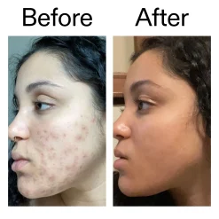The INKEY List Tranexamic Acid Serum 30ml