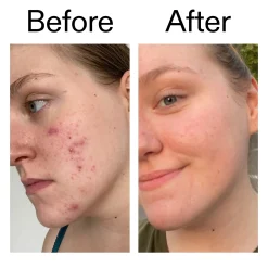 The INKEY List- 15% Vitamin C and EGF Serum 30ml