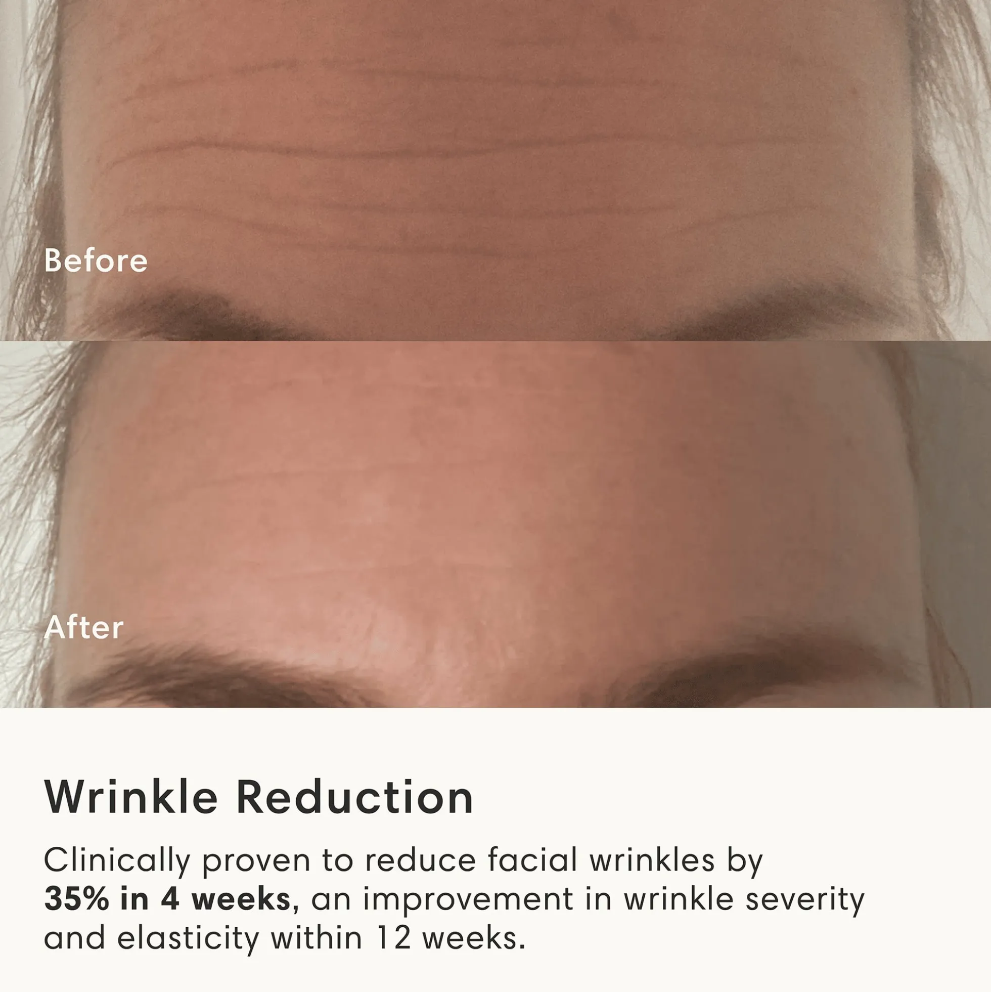 The Light Salon Boost LED Mask
