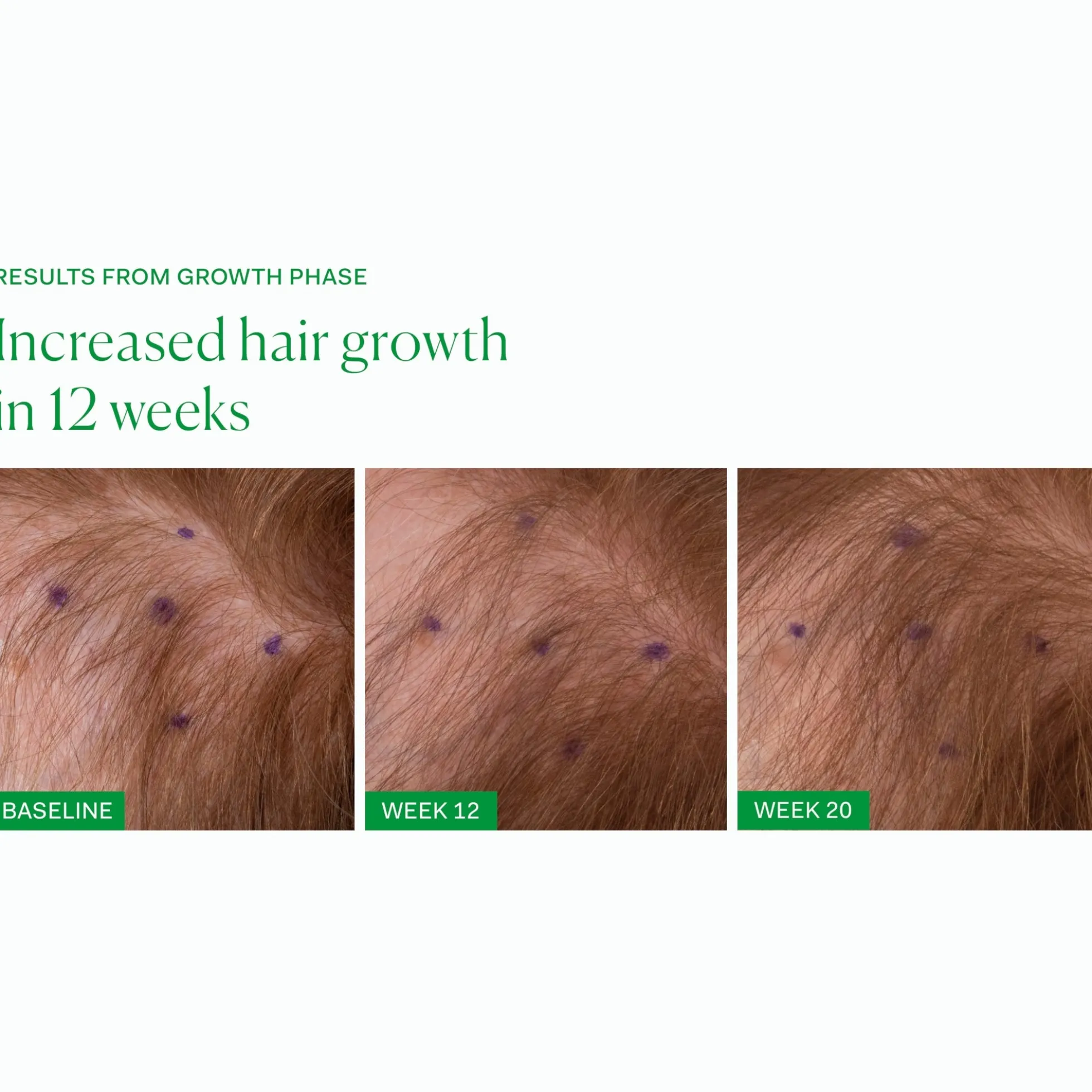 The Nue Co. Growth Phase Hair Supplements (90 Capsules)