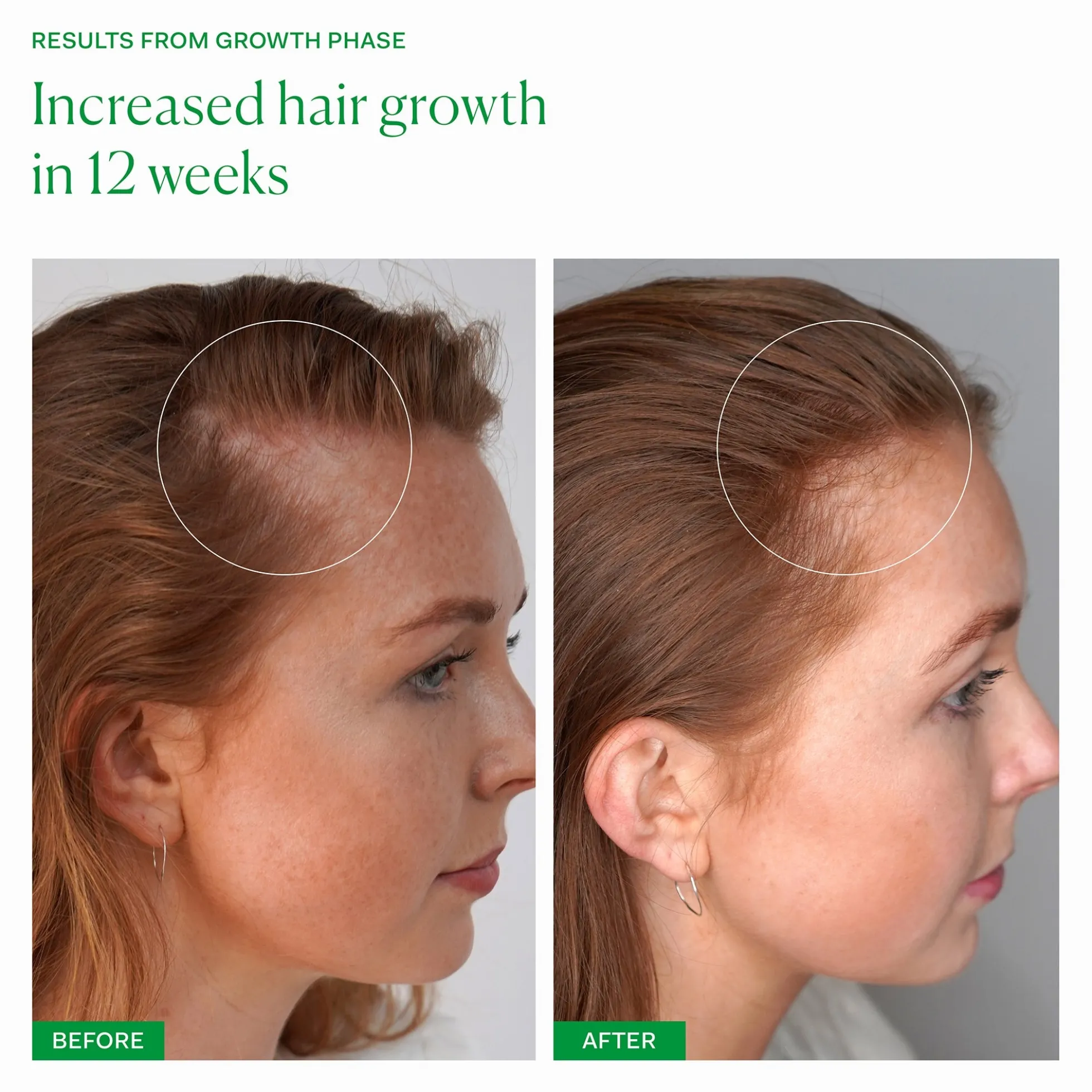 The Nue Co. Growth Phase Hair Supplements (90 Capsules)