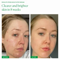 The Nue Co. Skin Filter Daily Brightening Phyto-Retinol + AHA Serum 30ml