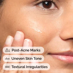 The Ordinary Aloe 2% + NAG 2% Solution Serum 30ml