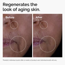The Ordinary GF 15% Serum for Visible Skin Repair and Wrinkles 30ml
