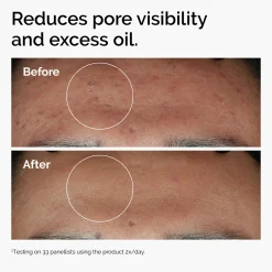 The Ordinary Niacinamide 10% + Zinc 1% Supersize Serum 60ml