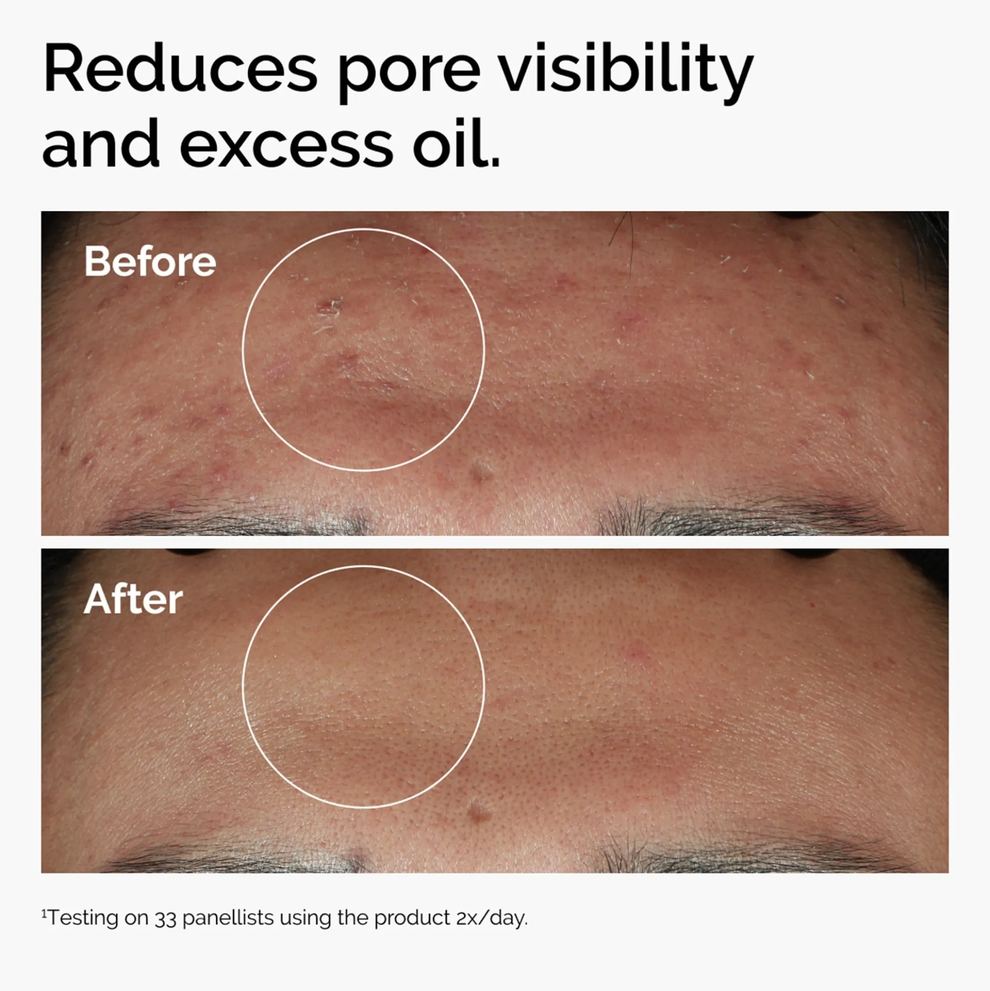The Ordinary Niacinamide 10% + Zinc 1% Supersize Serum 60ml