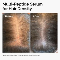 The Ordinary's Multi-Peptide Serum for Hair Density and Scalp Support 30ml
