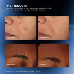 The Outset Total Clarity Dark Spot Serum 30ml