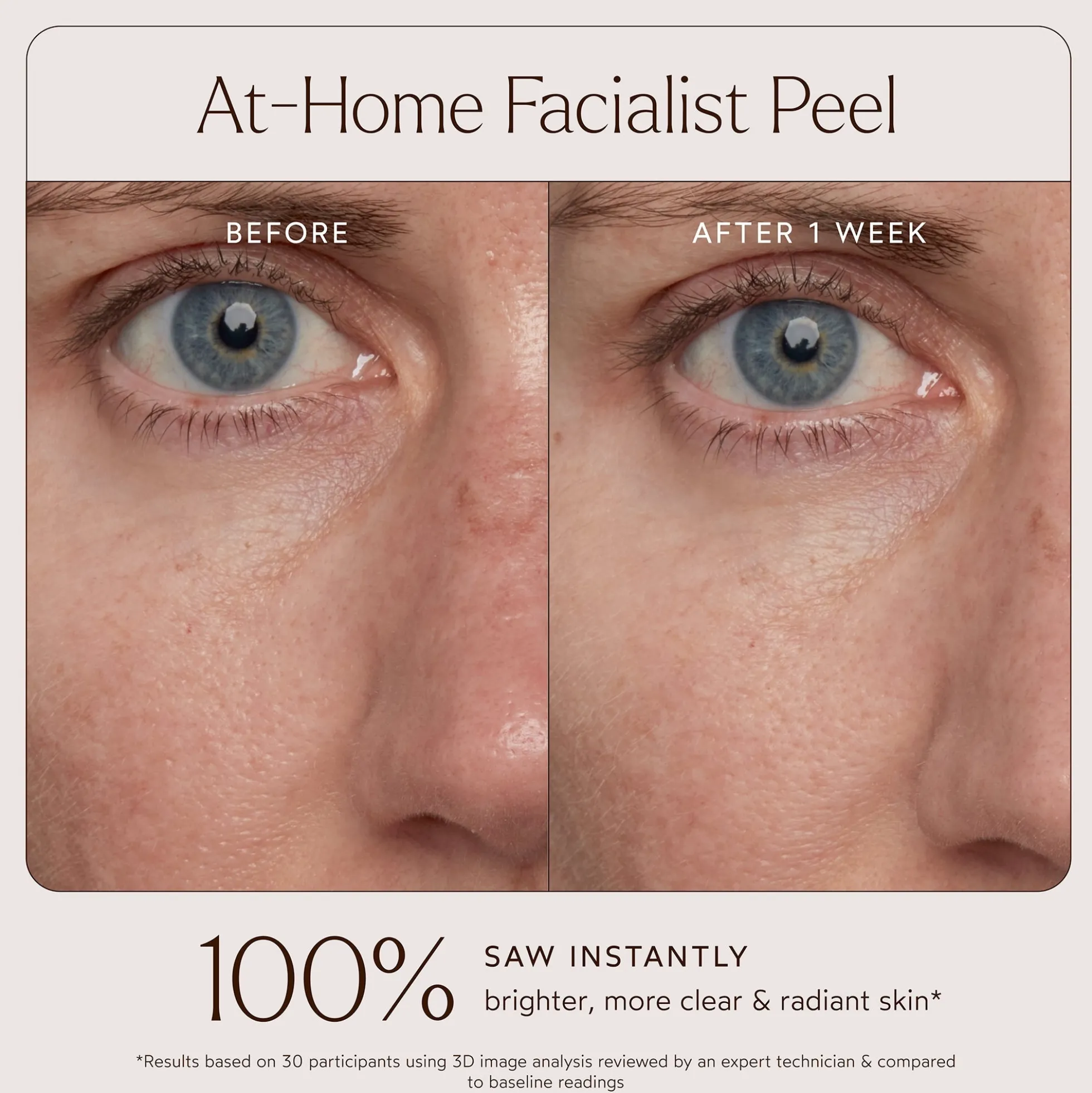 True Botanicals At-Home Facialist Peel 30ml
