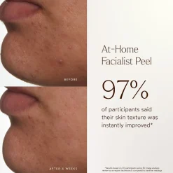True Botanicals At-Home Facialist Peel 30ml