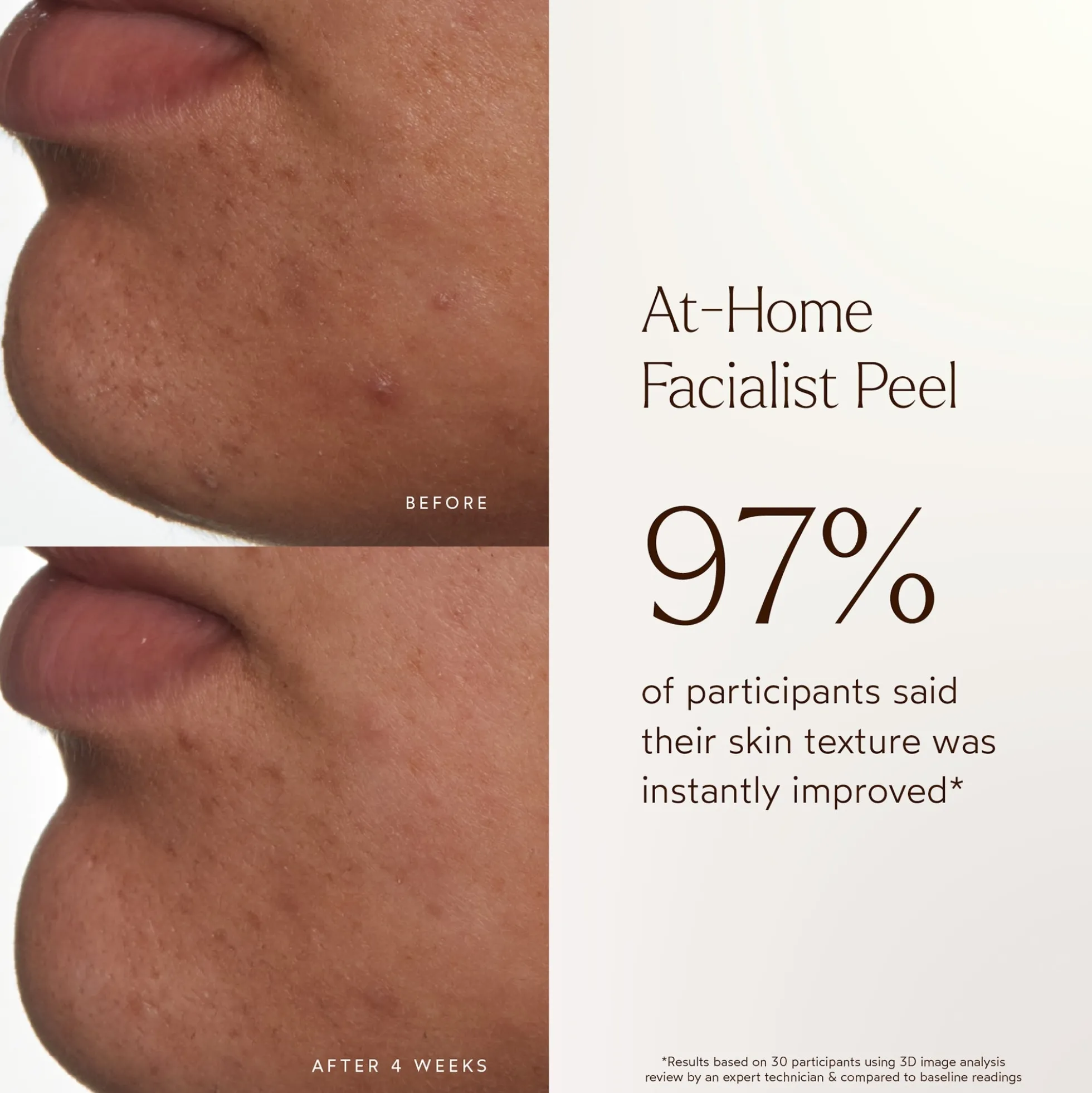 True Botanicals At-Home Facialist Peel 30ml