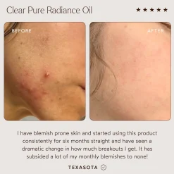 True Botanicals Clear Pure Radiance Oil 30ml
