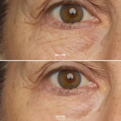 True Botanicals Eye Care Duo