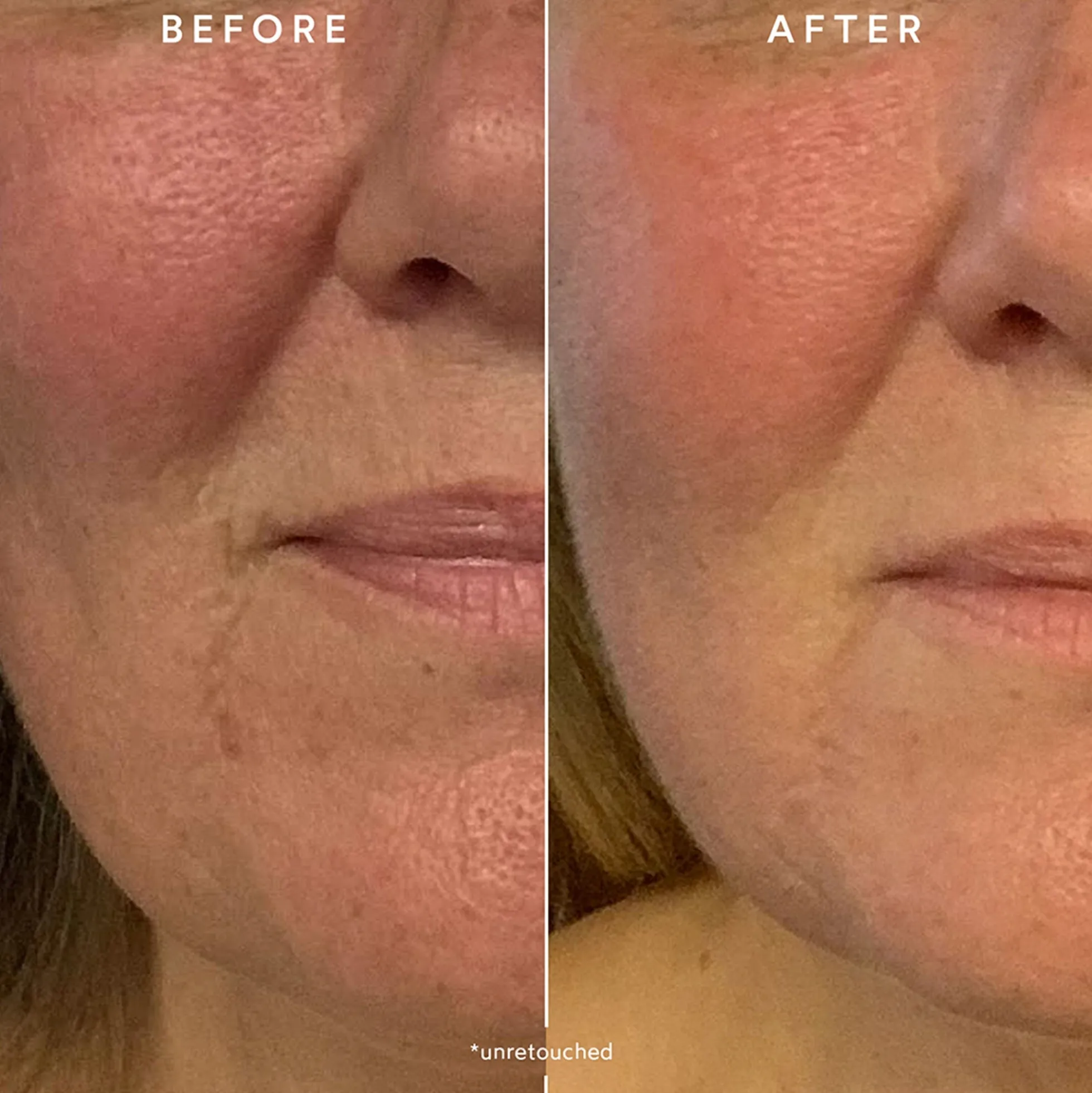 True Botanicals Renew Repair Nightly Treatment 30ml