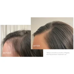 VIRTUE Flourish Hair Rejuvenation Treatment (3 Month Supply)